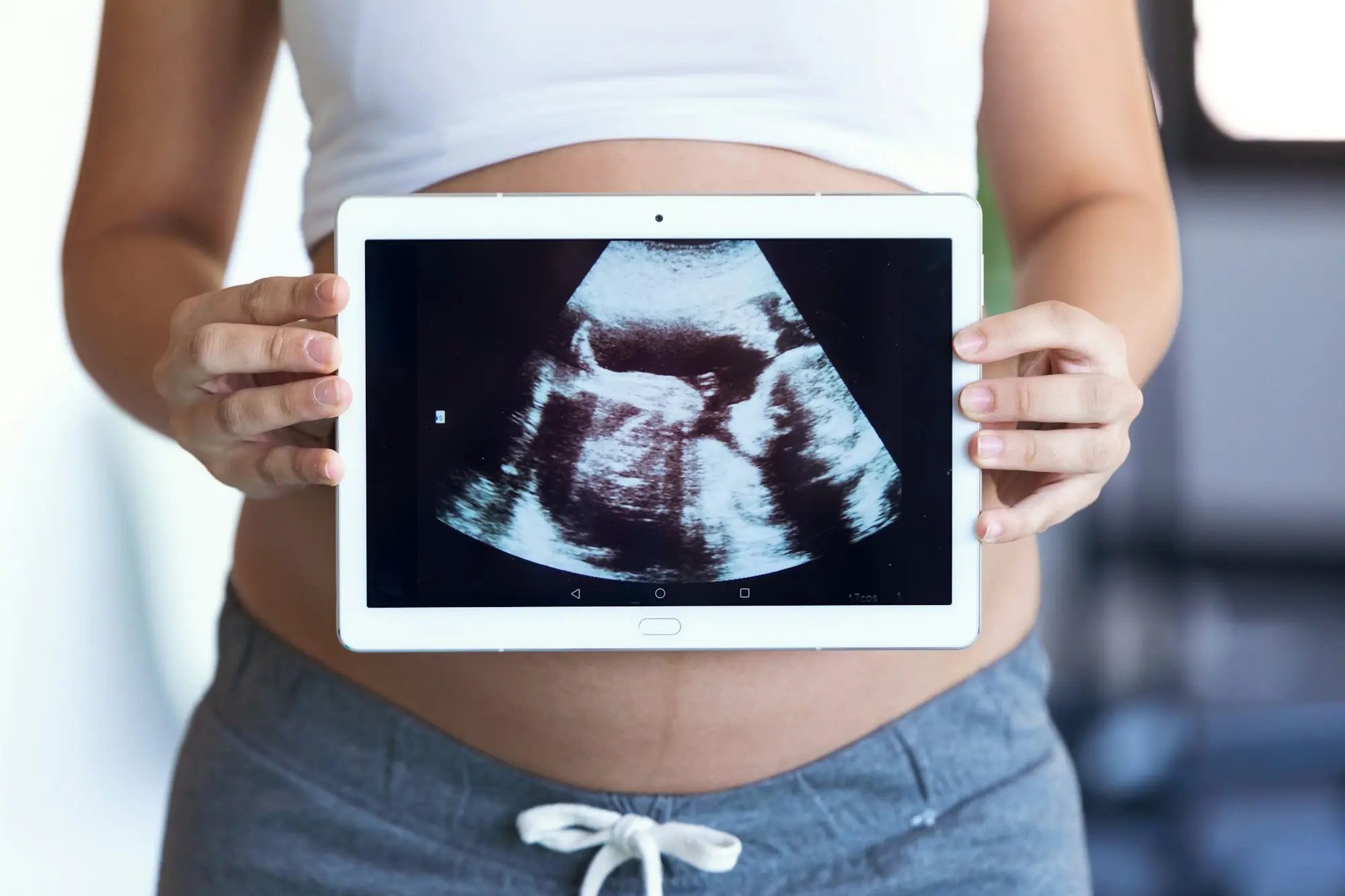 pregnant woman holding and showing digital tablet with fetal ultrasound photo